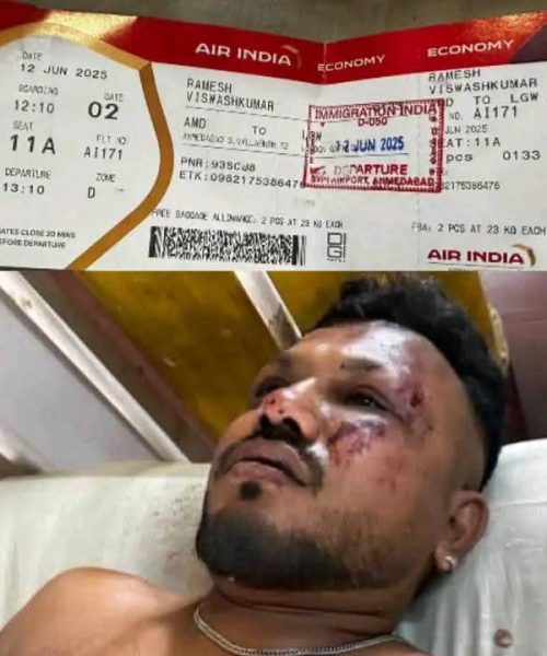 अहमदाबाद विमान दुर्घटनामा एकजना बेलायती नागरिक बाँच्न सफल